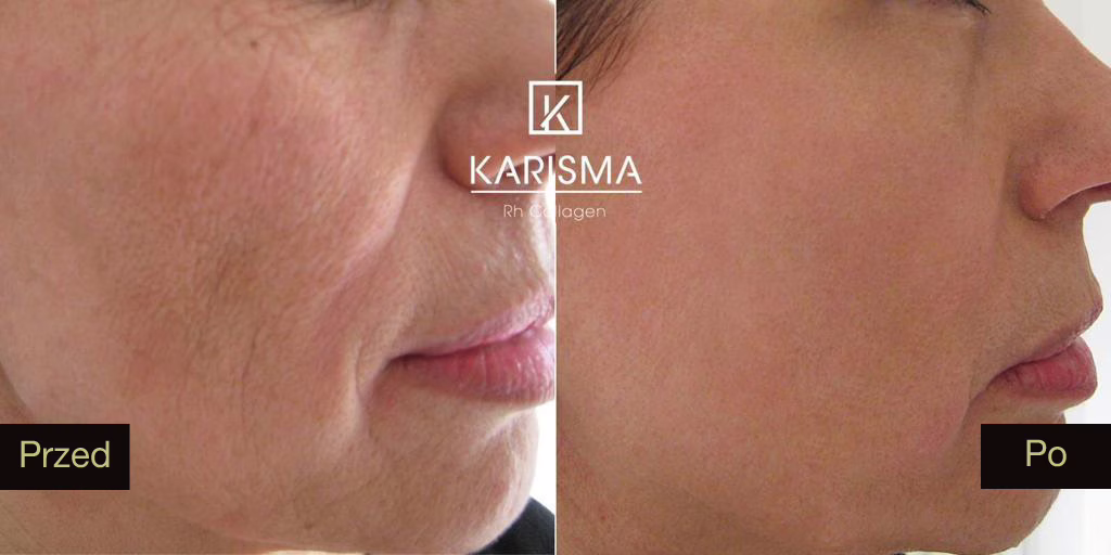 Karisma – Sekret Młodej, Jędrnej Skóry!