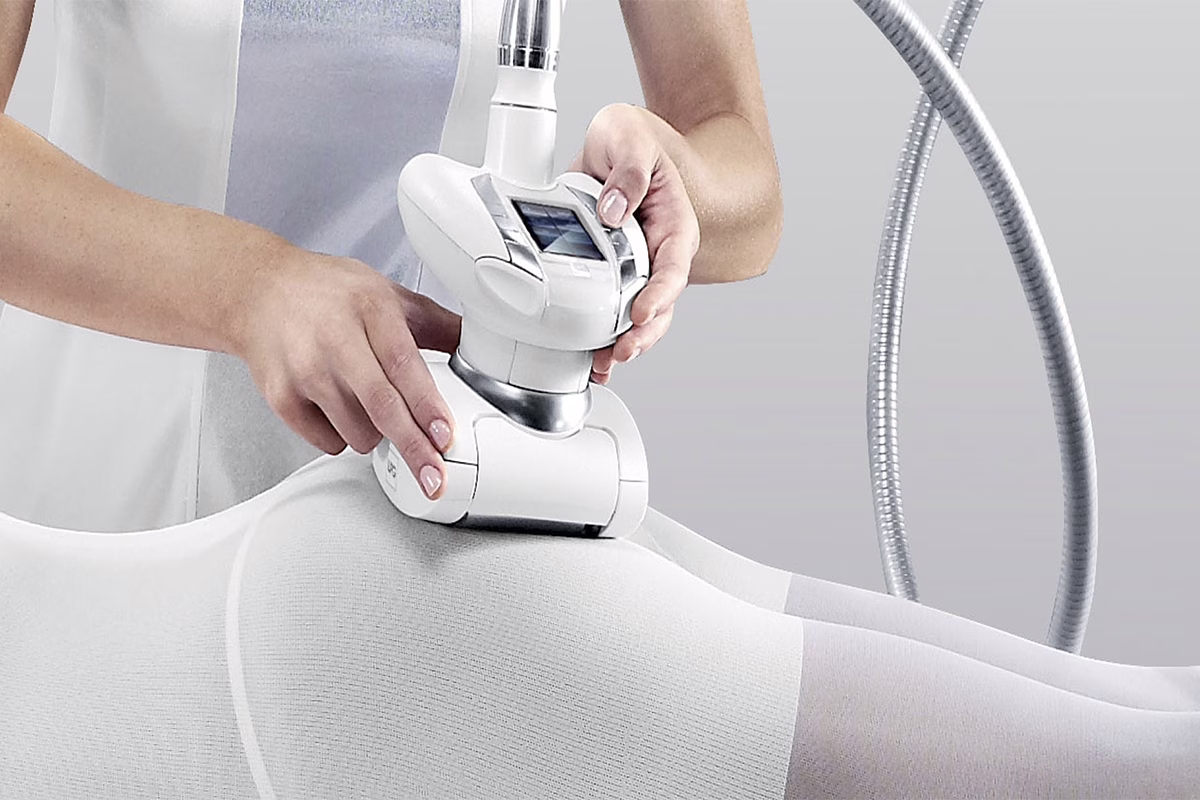 Podwójna moc regeneracji: Endermologia LPG Alliance + Storz Medical